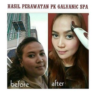 ASLI KEREEEENNN BANGETTTTT HASILLL PERAWATAN SENDIRI DI RUMAH PK GALVA, SUDAH BEJIBUNN YG MEMBUKTIKAN, KAMUUU KAPAN? WORTH IT BANGET INI SAYYYY ALATT SETRIKA WAJAH TERKECIL DI DUNIA
.
Order GALVANIC FACE SPA sekarang jugaa 
.
SUMPAH kamu butuh banget si Galvanic Spa Face ini
Kenapa?
Bisa menghemat perawatan kecantikan mu di klinik spa, hemat
Alat bisa dipakai sekeluarga,  efesien
Bisa digunakan kapan dan  dimana saja, efektif
Gak butuh waktu lama, no ribet
1 alat bisa dipakai di wajah,  badan dan rambut, komplit Bisa jadi bisnis sampingan,  WOW  Soal manfaat?? Amazing
Manfaat Galvanic Spa untuk Wajah :
1. Mengencangkan wajah
2. Menghilangkan keriput
3. Menghilangkan flek2
4. Mencerahkan wajah
5. Mengangkat kelopak mata
6. Memudarkan kantung mata
7. Meratakan tekstur kulit yg berlubang bekas jerawat
Manfaat Galvanic Spa untuk Tubuh :
1. Menghancurkan lemak
2. Mengencangkan lengan yg bergelambir
3. Membentuk tubuh
4. Menghilangkan selulit
5. Memudarkan strechmark
6. Memudarkan keloid
Manfaat Galvanic Spa untuk Rambut :
1. Menyuburkan rambut
2. Meningkatkan volume rambut
3. Menguatkan akar rambut
4. Menyehatkan rambut dan kulit kepala
5. Meratakan pertumbuhan rambut
.
PASTI KAMU BUTUHH SEMUA FUNGSI DARI GALVANIC SPA INI , yaaa kannnn sayyyy ... 
.
ORDER & JOIN MEMBER (FAST RESPON)
 WA : 081288099622
*GRATIS KONSULTASI*
.
#nuskinjakartatimur #nuskinindonesiaa
#lumispa #lumispanuskin #facialgel #exponuskin #nuskinexpo #like4likes #like4follow#like4love #like4like#Instafollow#like4followbeautygram#beautylover#likeforlikes#like4likes#instagood#instahealth #quotes #quotesbusiness#pebisnis #nuskinjakarta#antiaging#truface#galvanicspa#ap24 #scionrollon #napca #ragamkecantikanofficial